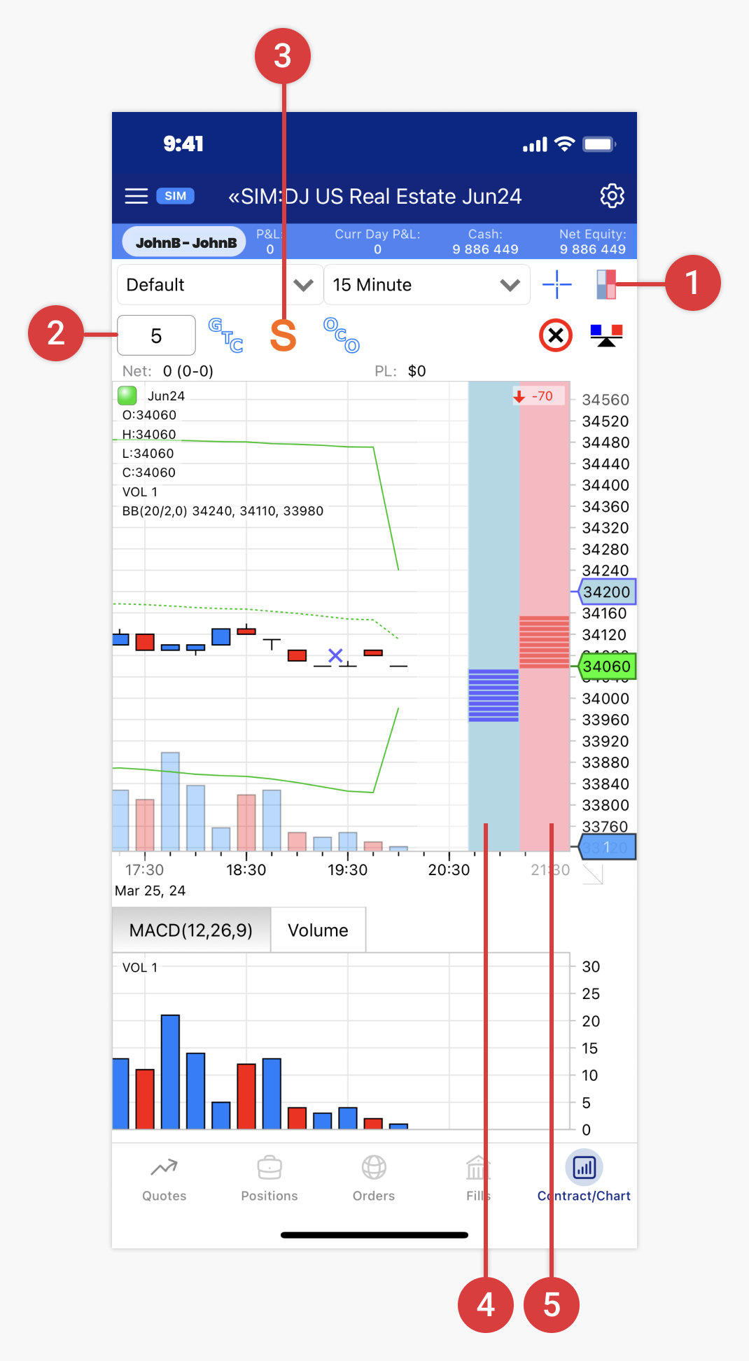 trading-from-charts-stopmarket-1-ios.png
